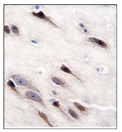 AP12427PU-N - Neuron specific enolase