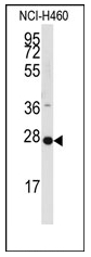 AP12449PU-N - PPAP2C / LPP2