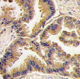 AP11667PU-N - BMP6
