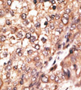 AP11668PU-N - BMP7