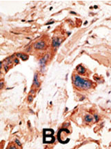 AP11673PU-N - BMP2K / BIKE