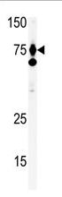 AP11675PU-N - Hepatocyte growth factor / HGF