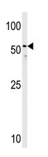 AP11651PU-N - Histamine H3 receptor