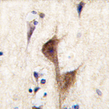 AP11651PU-N - Histamine H3 receptor