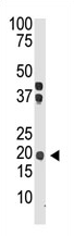 AP11656PU-N - Interleukin-28A / IL28A