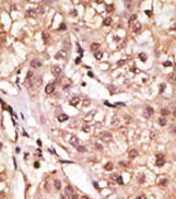 AP11658PU-N - Interleukin-29 / IL29