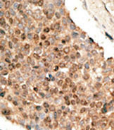 AP11659PU-N - BMP10
