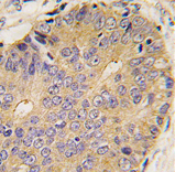 AP11661PU-N - BMP15 / GDF9B