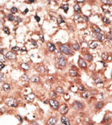 AP11666PU-N - BMP5