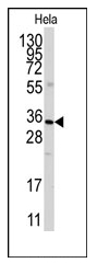 AP12480PU-N - Annexin A3 / ANXA3