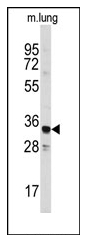 AP12481PU-N - Annexin A3 / ANXA3