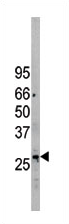 AP11734PU-N - EIF2B3