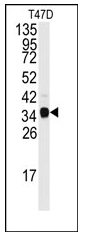 AP12488PU-N - Nucleophosmin
