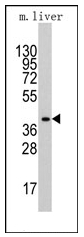 AP12350PU-N - Aldolase A / ALDOA