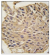 AP12350PU-N - Aldolase A / ALDOA