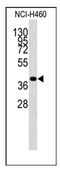 AP12354PU-N - Chondromodulin-1