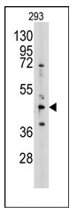 AP12359PU-N - AdoHcyase / AHCY