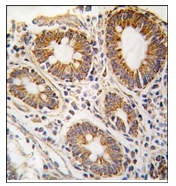 AP12359PU-N - AdoHcyase / AHCY