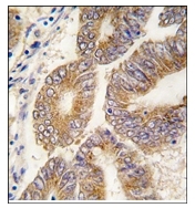 AP12360PU-N - AdoHcyase / AHCY