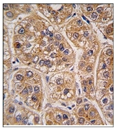 AP12362PU-N - AKR1A1 / ALDR1