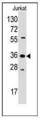 AP12364PU-N - AKR1B1 / ALDR1