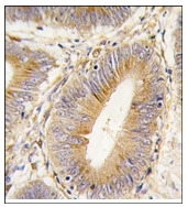 AP12364PU-N - AKR1B1 / ALDR1