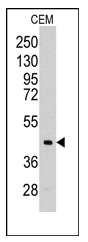 AP12365PU-N - Aldolase C / ALDOC