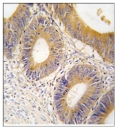 AP12365PU-N - Aldolase C / ALDOC