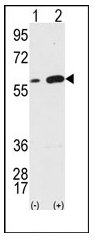 AP12371PU-N - Vimentin