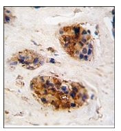 AP12371PU-N - Vimentin