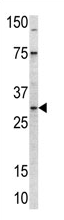 AP11753PU-N - MRPL24