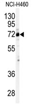 AP11756PU-N - CSTF2