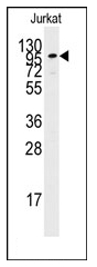 AP12381PU-N - Adenylate cyclase type 2
