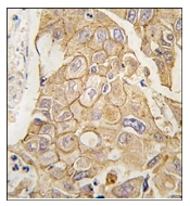 AP12381PU-N - Adenylate cyclase type 2