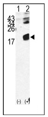 AP12414PU-N - Beta-2-microglobulin