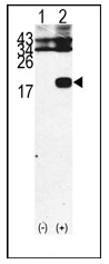 AP12415PU-N - Beta-2-microglobulin