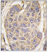 AP12415PU-N - Beta-2-microglobulin