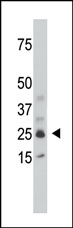 AP12289PU-N - SULT1C2 / SULT1C1