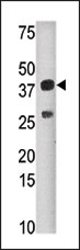 AP12300PU-N - SULT1C4 / SULT1C2