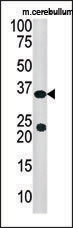 AP12302PU-N - SULT4A1