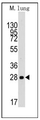 AP12304PU-N - Cyclin D1