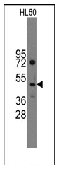 AP12312PU-N - Indian hedgehog protein / IHH