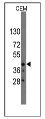 AP12314PU-N - QKI / Protein quaking