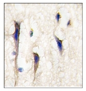 AP12327PU-N - ARHGEF9