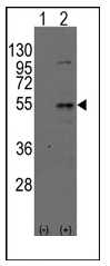AP12328PU-N - Dysbindin