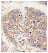AP12328PU-N - Dysbindin