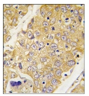AP12329PU-N - Dysbindin