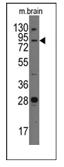 AP12331PU-N - Junctophilin-3 / JPH3