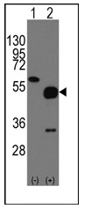 AP12334PU-N - Neuronal pentraxin-2