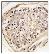 AP12334PU-N - Neuronal pentraxin-2
